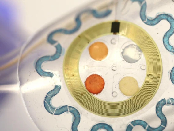 A soft, wearable microfluidic device for the capture, storage, and colorimetric sensing of sweat