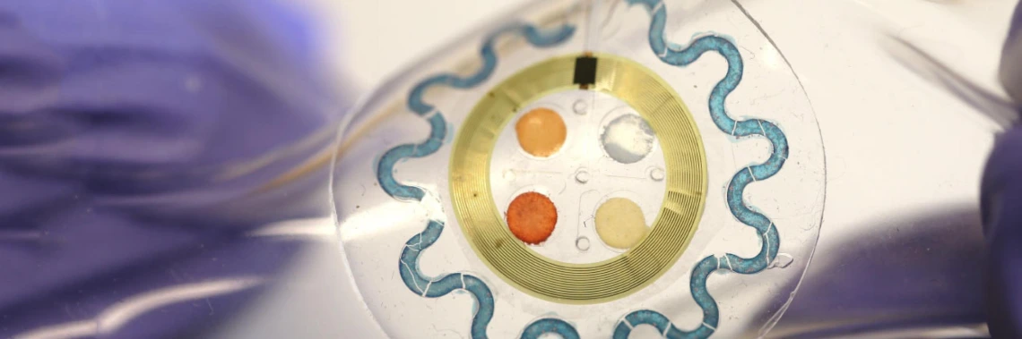 A soft, wearable microfluidic device for the capture, storage, and colorimetric sensing of sweat